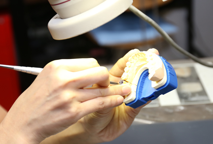 歯科技工所併設で時間短縮